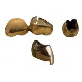 18k Gold Dental Restorations