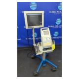 SonoSite 180 Plus Portable Ultrasound w/ Cart