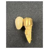 Gold tooth?