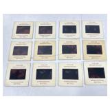 Vtg Oddity & Medical Procedure Photo Slides