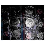 1975 U.S. Mint Uncirculated Coin sets