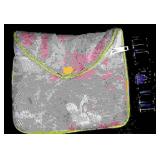 RADO Jubile DiaStar Lux Women