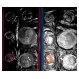 1976 U.S. Mint Uncirculated Coin sets