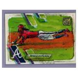 Ronald Acuna Jr. Topps Shoebox Treasures
