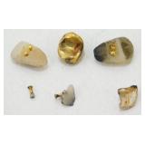 Gold Teeth Cap and Teeth with Gold Pins - Gold