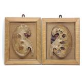 Pair of Vintage Anatomical Kidney Models