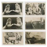 Dr Locke Toe Twister Ontario RPPC Postcards