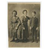 Siamese Twins Rosa Josepha Blazek Photo