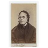 Blind Woman Missing an Eye CDV Photo